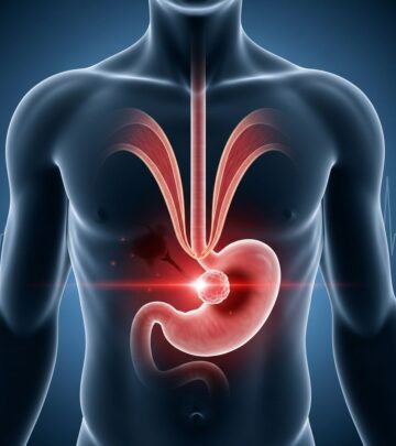 Understanding the link between chronic heartburn and esophageal cancer